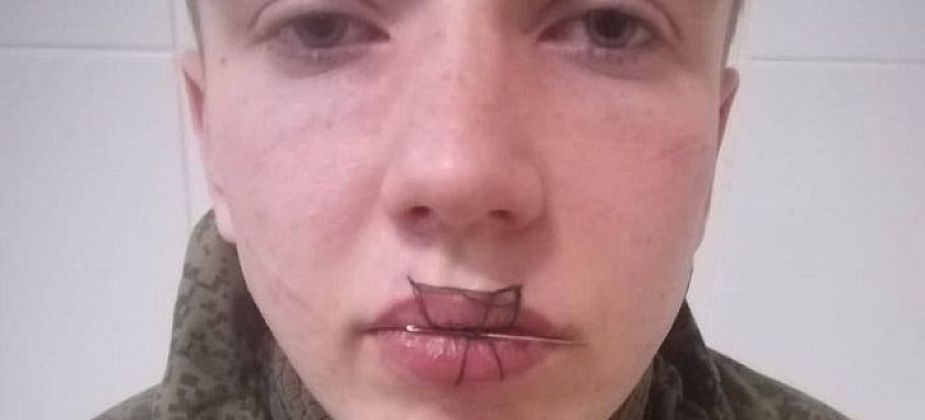 19-летний солдат, зашивший себе рот, учился в духовной семинарии и пел в церковном хоре