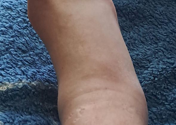 Ногу сломала, рентген в приемном покое не работал - всех отправляли на снимок в Краснотурьинск